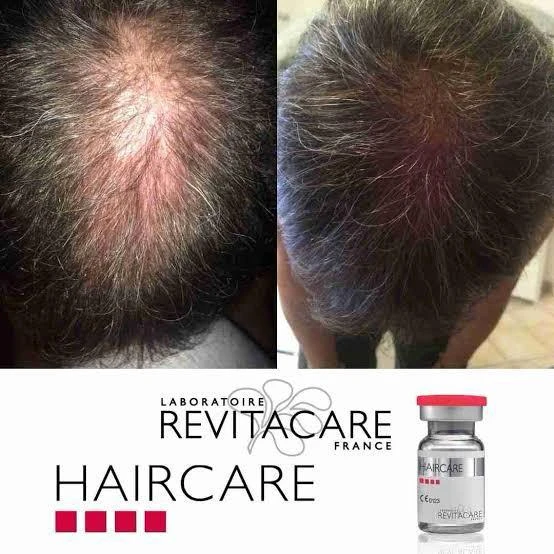 محصول Revitacare Haircare برای درمان ریزش و ضعف مو